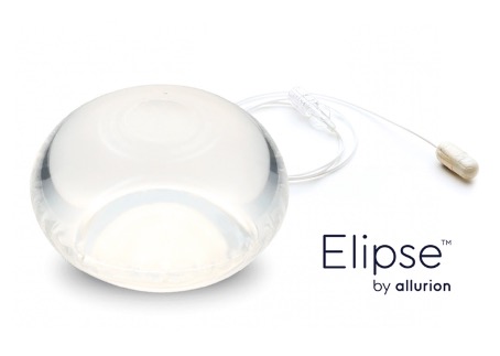 Yutulabilir Mide Balonu ile Nasıl Kilo Verilir