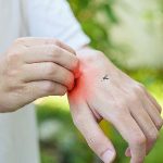 sivrisinek-isirmasindan-sonra-yuksek-ates-ve-eklemlerde-agri-varsa-mutlaka-doktorunuza-danisin.jpg