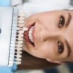 Antalya Diş Beyazlatma - Diş Hekimi Funda Özen