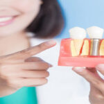 Antalya İmplant Tedavisi | Dentist Özgür Yıldırım