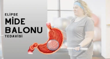 Yutulan Mide Balonu Fiyat