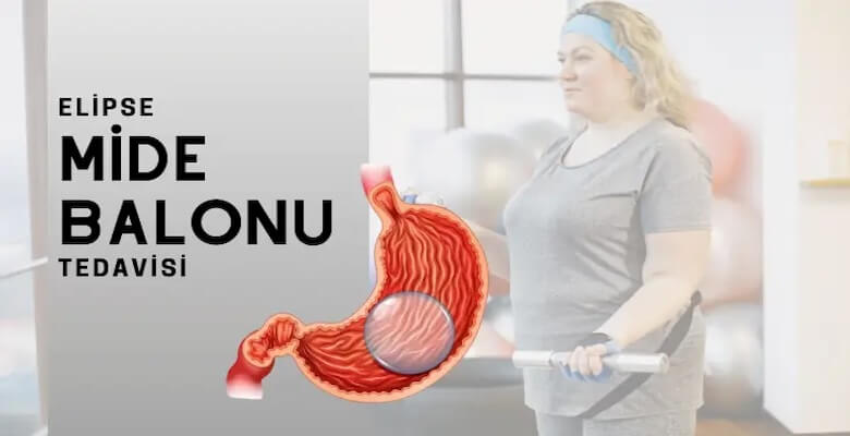 Yutulan Mide Balonu Fiyat