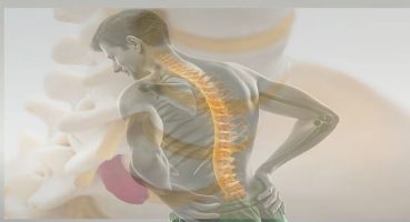 Ağrısız Dönem Aldatıcıdır: Bel Fıtığı Ameliyatı Sonrası Neden Tekrarlar?