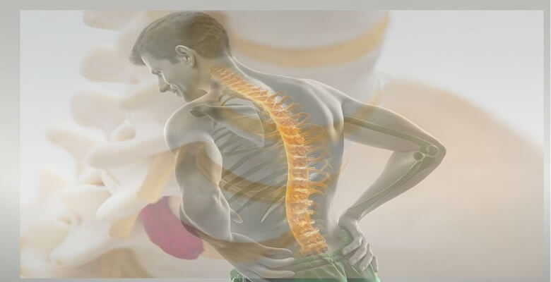 Ağrısız Dönem Aldatıcıdır: Bel Fıtığı Ameliyatı Sonrası Neden Tekrarlar?